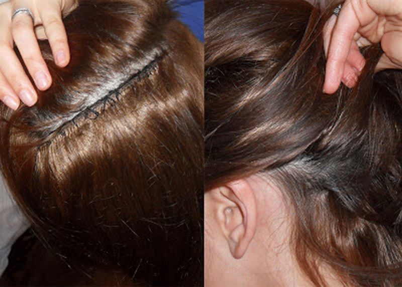 Hair braids Remove